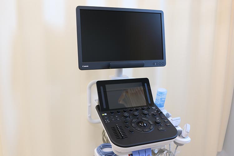 超音波診断装置